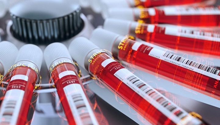 Farmasötik endüstrisinde santrifüj uygulaması